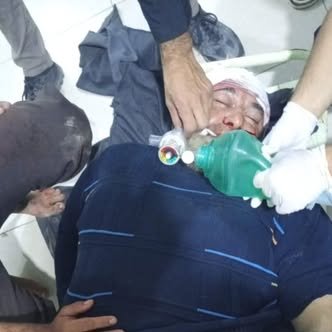 Letzte Nacht wurde ein Mann, der aus der Provinz Deir ez-Zur vertrieben wurde und in Afrin (Nord-Aleppo) lebt, in den Kopf geschossen. Er hatte kürzlich an Protesten teilgenommen, in denen er die Regierung aufforderte, die Besetzung seiner Heimatregion durch die SDF zu beenden, damit er dorthin zurückkehren könne. Sein Zustand ist kritisch.